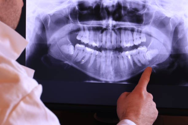 Best 24-Hour Emergency Dentist in New London, TX
