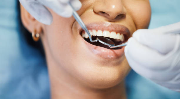 Best Emergency Dental Care for Trauma or Injury in New London, TX